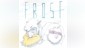 Frost